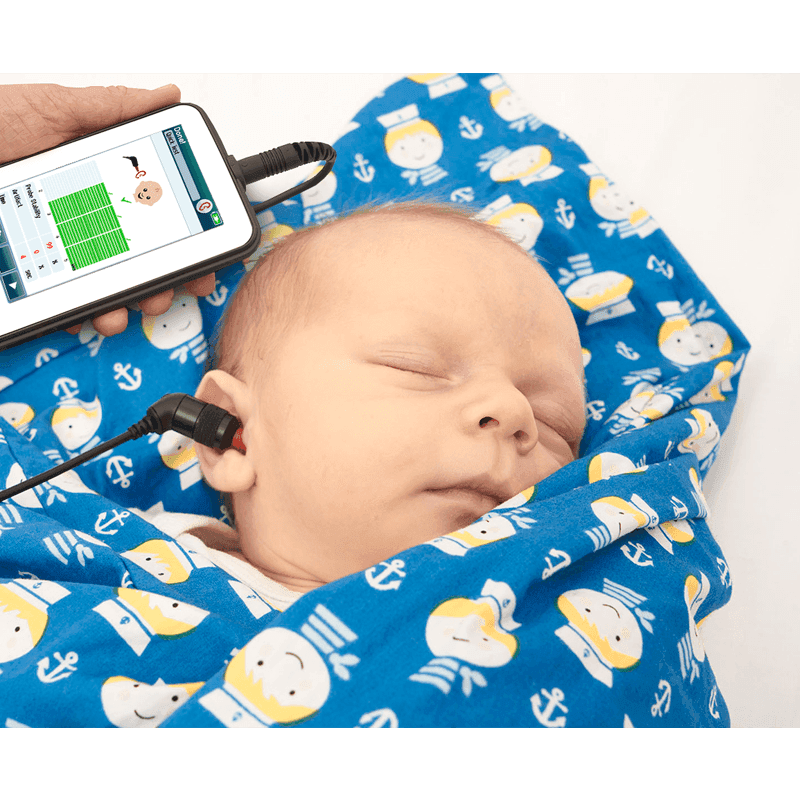 xsera_oae_abr4_800x800